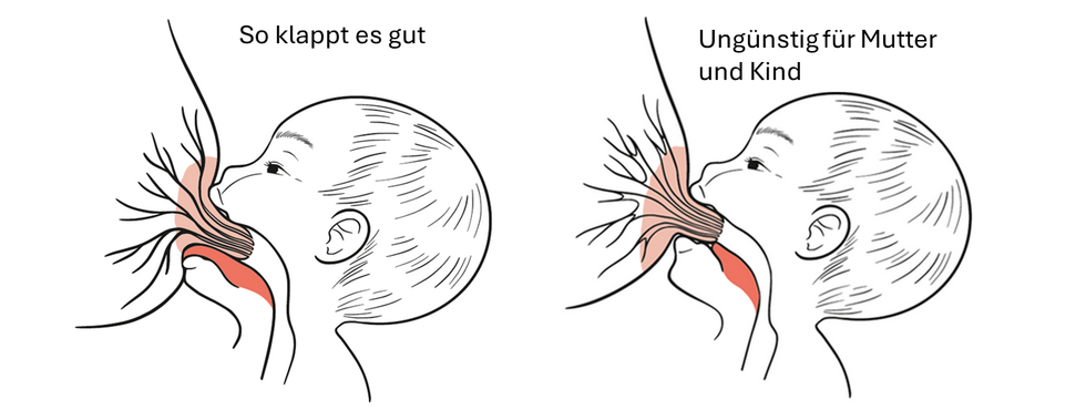 Zeichnung mit günstiger und ungünstiger Anlegetechnik