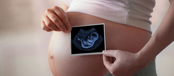 Schwangere hält Ultraschallbild